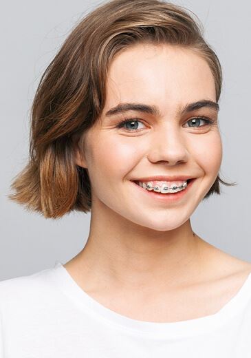 Aparat dentar metalic