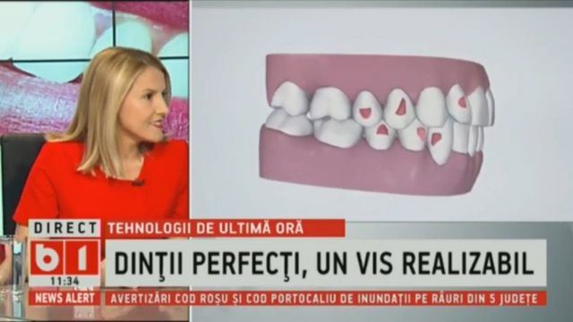 Zâmbet de STAR. Tehnologii stomatologice de ultimă oră I B1 TV